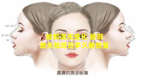 脸部激光变化 脸部激光祛斑后多久能恢复